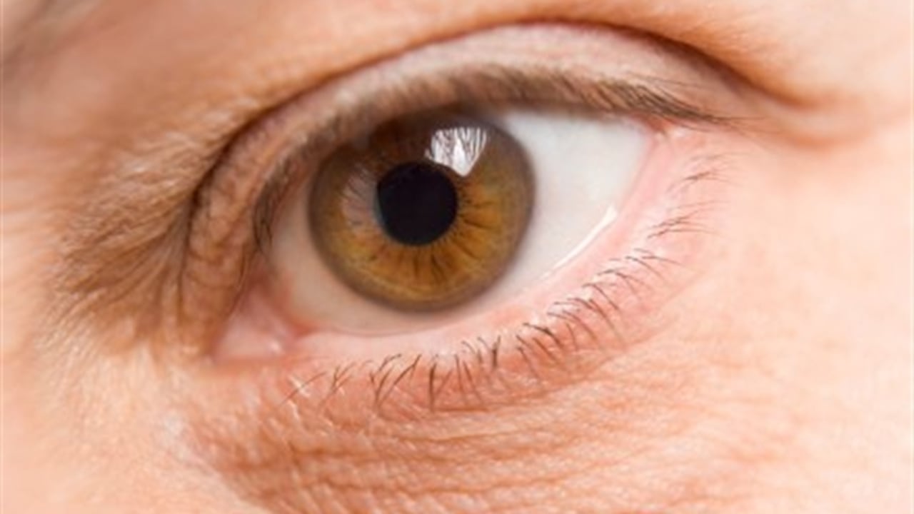 Remedios caseros contra las ojeras, foto: Thinkstock