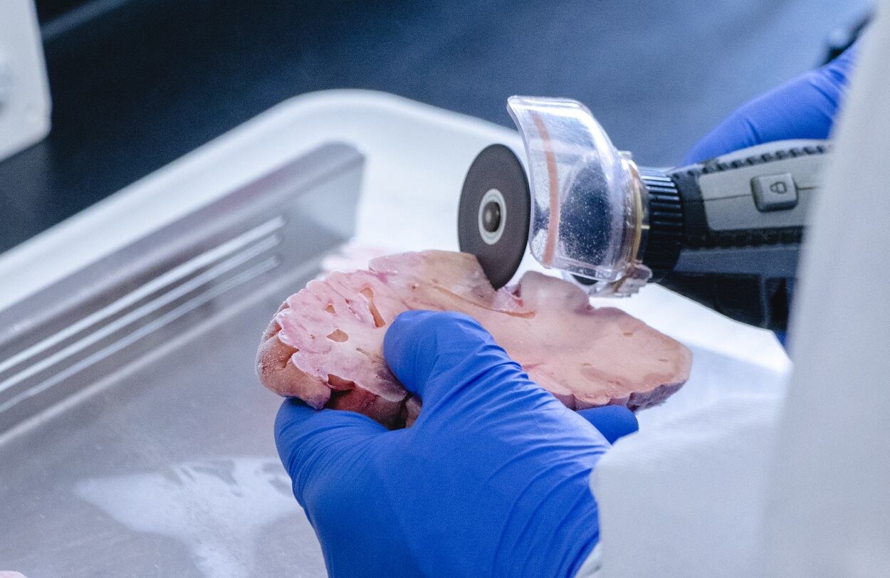 El Banco de Cerebros del Grupo de Neurociencias de Antioquia fue clave en la investigación.