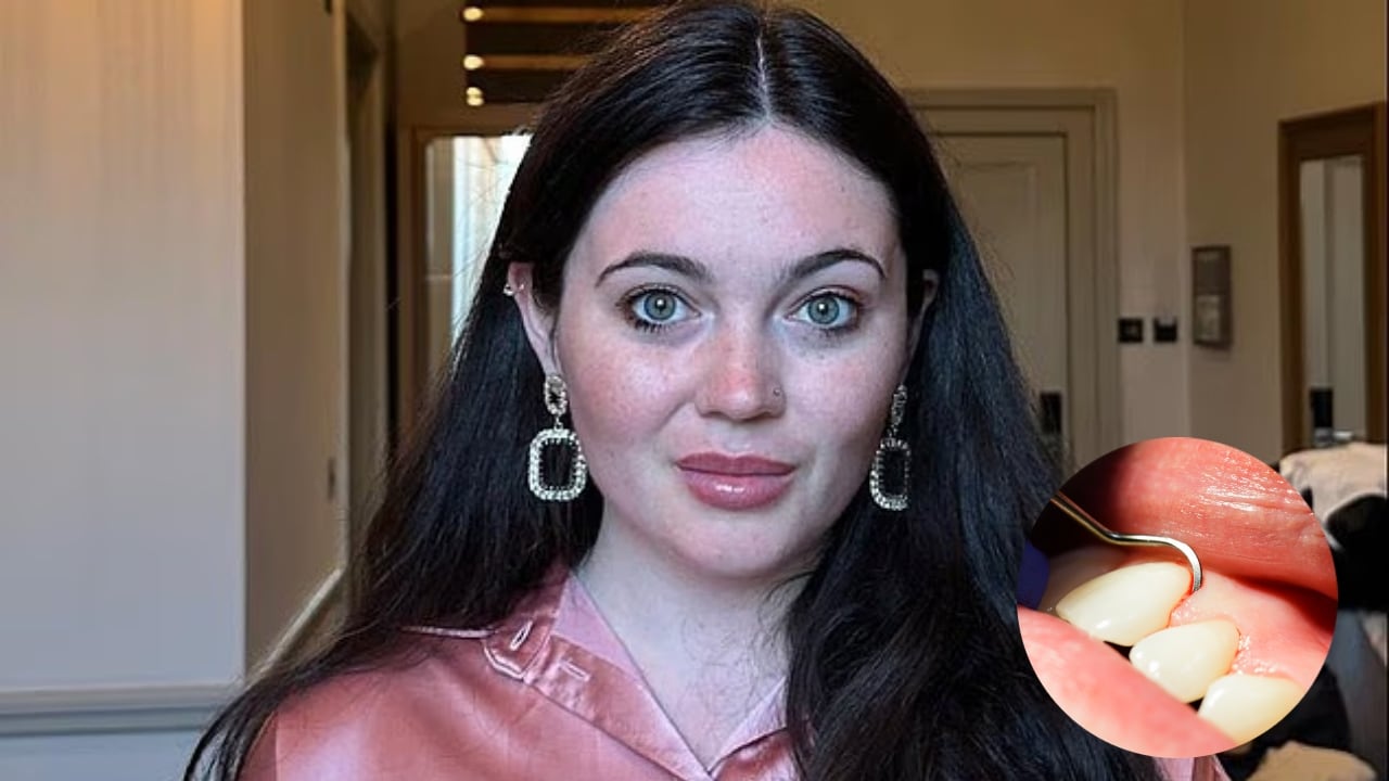 Amber Cunningham-Rogan y encía sangrando.