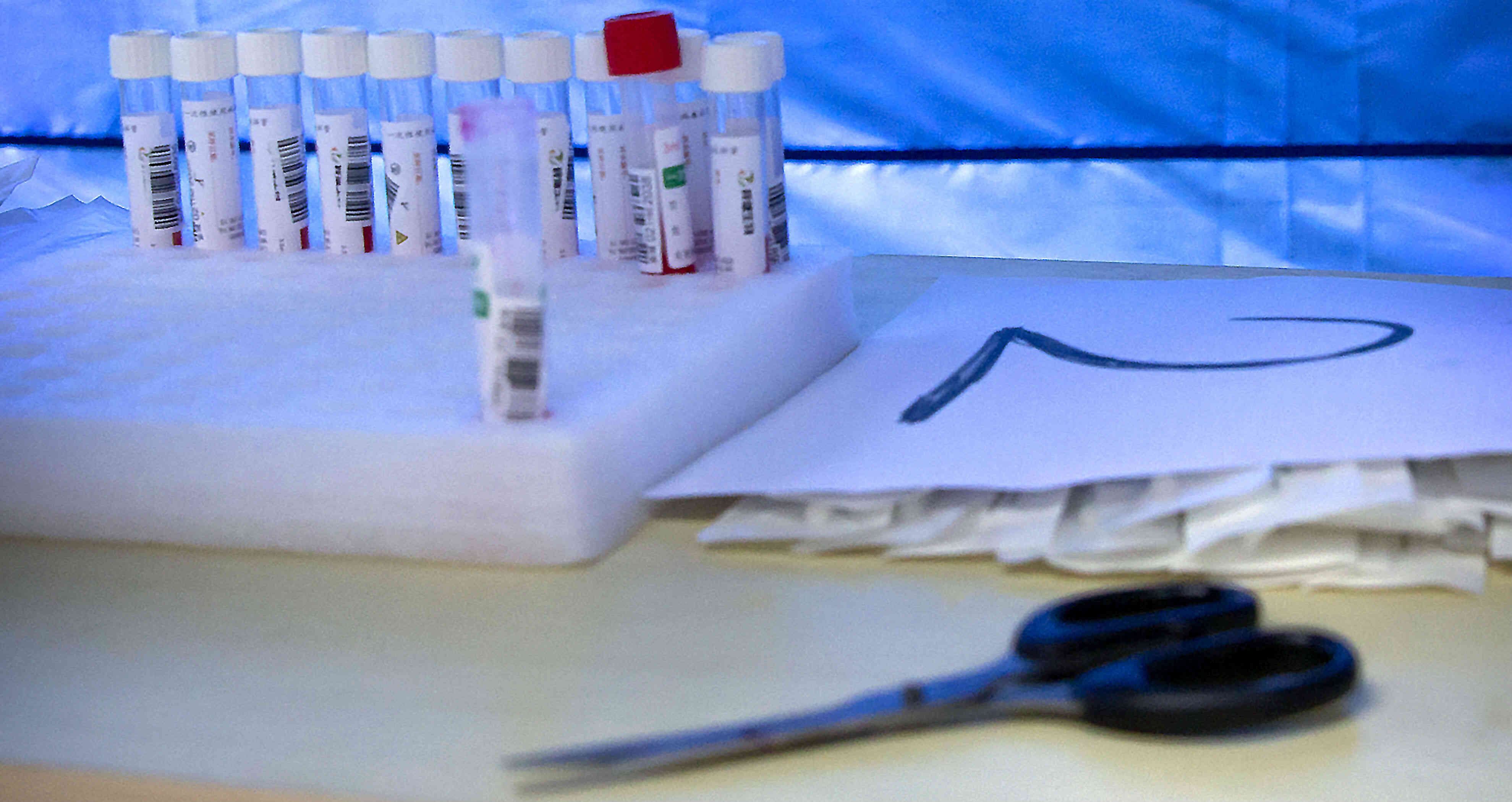 el VIH causa el Sida