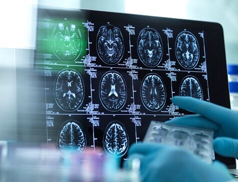 Los expertos han advertido que de la misma manera como los órganos del cuerpo cambian a medida que pasan los años y entramos a la etapa del envejecimiento, el cerebro también sufre cambios significativos.