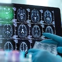 Los expertos han advertido que de la misma manera como los órganos del cuerpo cambian a medida que pasan los años y entramos a la etapa del envejecimiento, el cerebro también sufre cambios significativos.