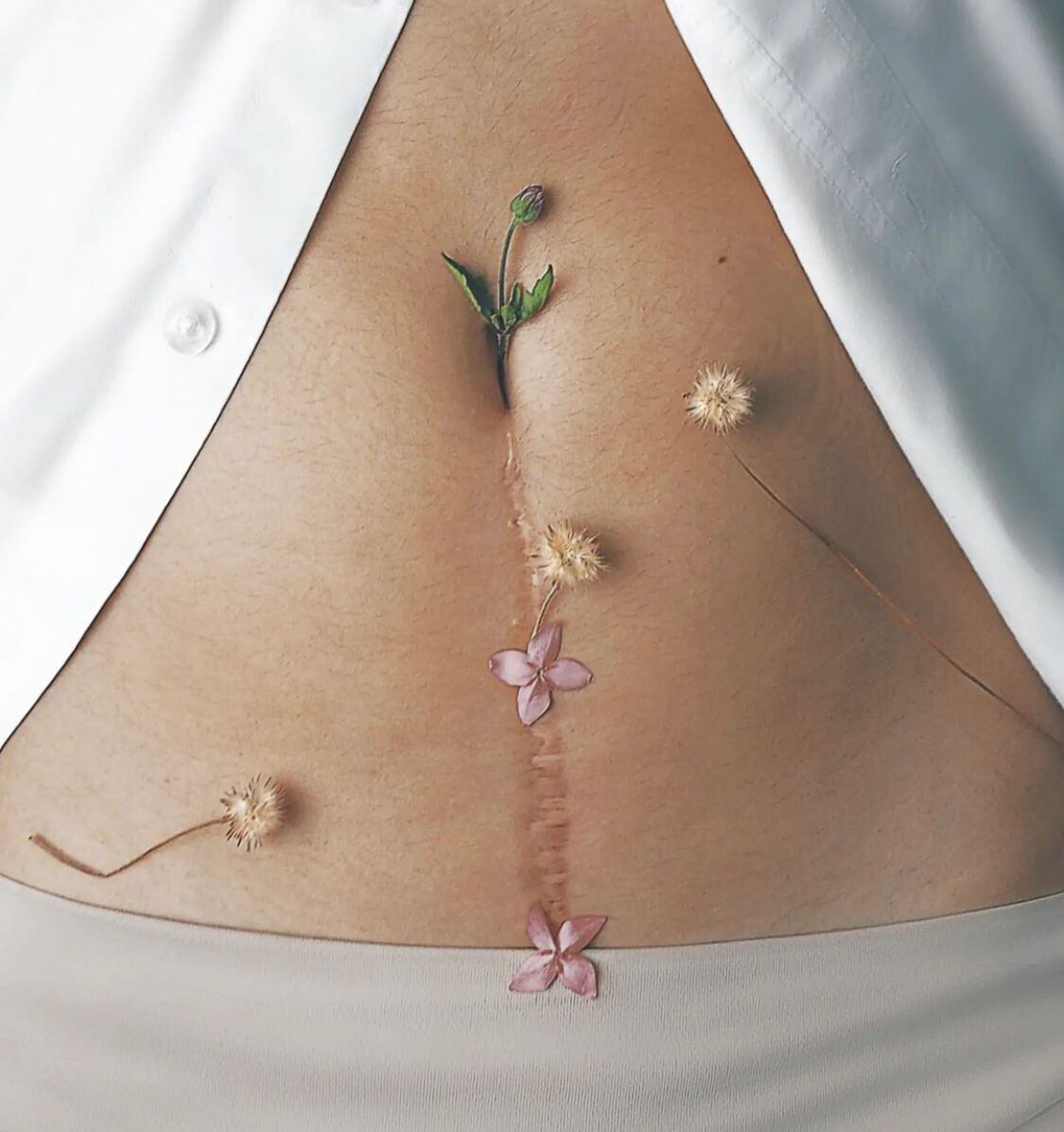 La actriz mexicana se sometió a una histerectomía debido al cáncer de cuello uterino