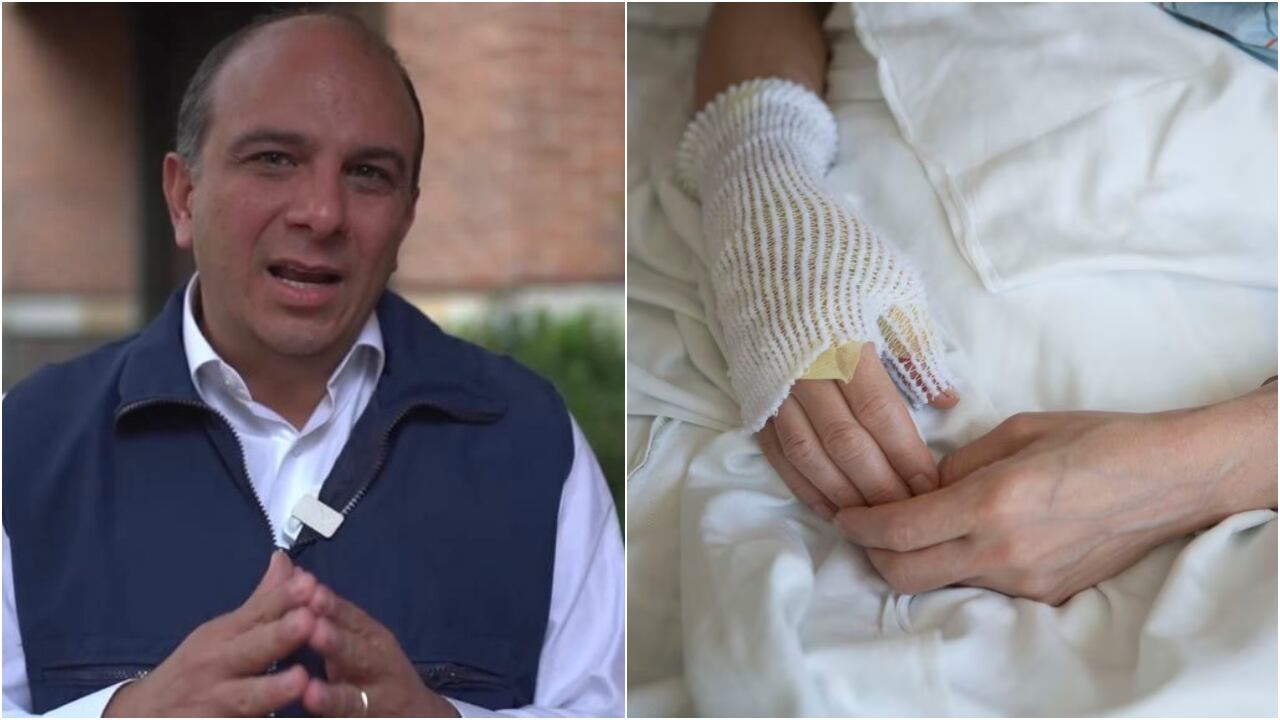 Defensor del Pueblo, Carlos Camargo Assis, pide reforzar acciones para que no haya más quemados con pólvora