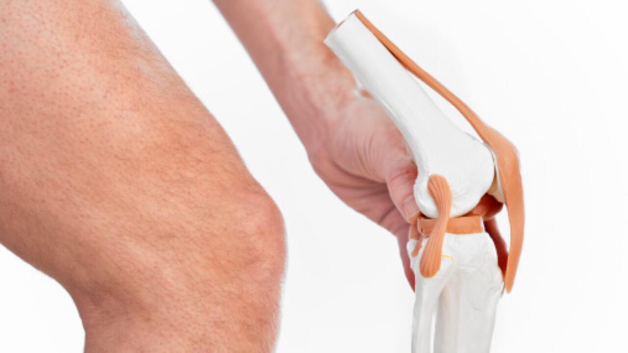 La osteoartritis provoca que el cartílago que protege los huesos de la rodilla se rompa y se vuelva más áspero.