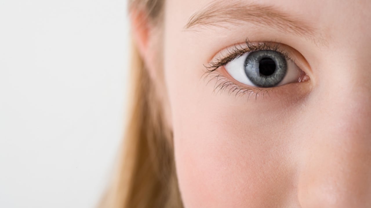 La anemia se puede reflejar a través de los ojos.