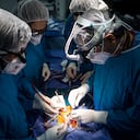 LaCardio hace 500 de las 2.300 cirugías de cardiopatías congénitas que se realizan al año en Colombia.