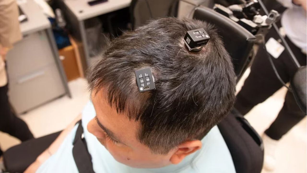 Thomas se está recuperando de forma natural, lo que podría revertir parte del daño de manera permanente.