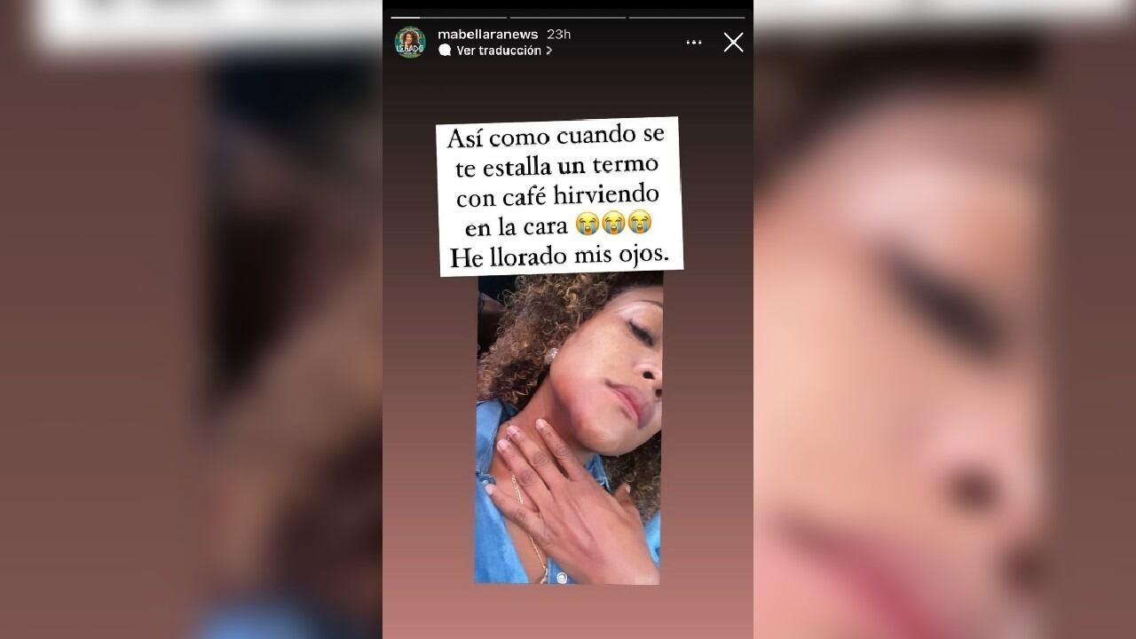 Mabel Lara, accidente casero