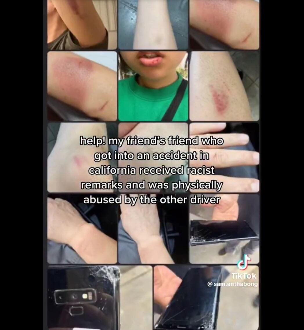 Ataque racista TikTok