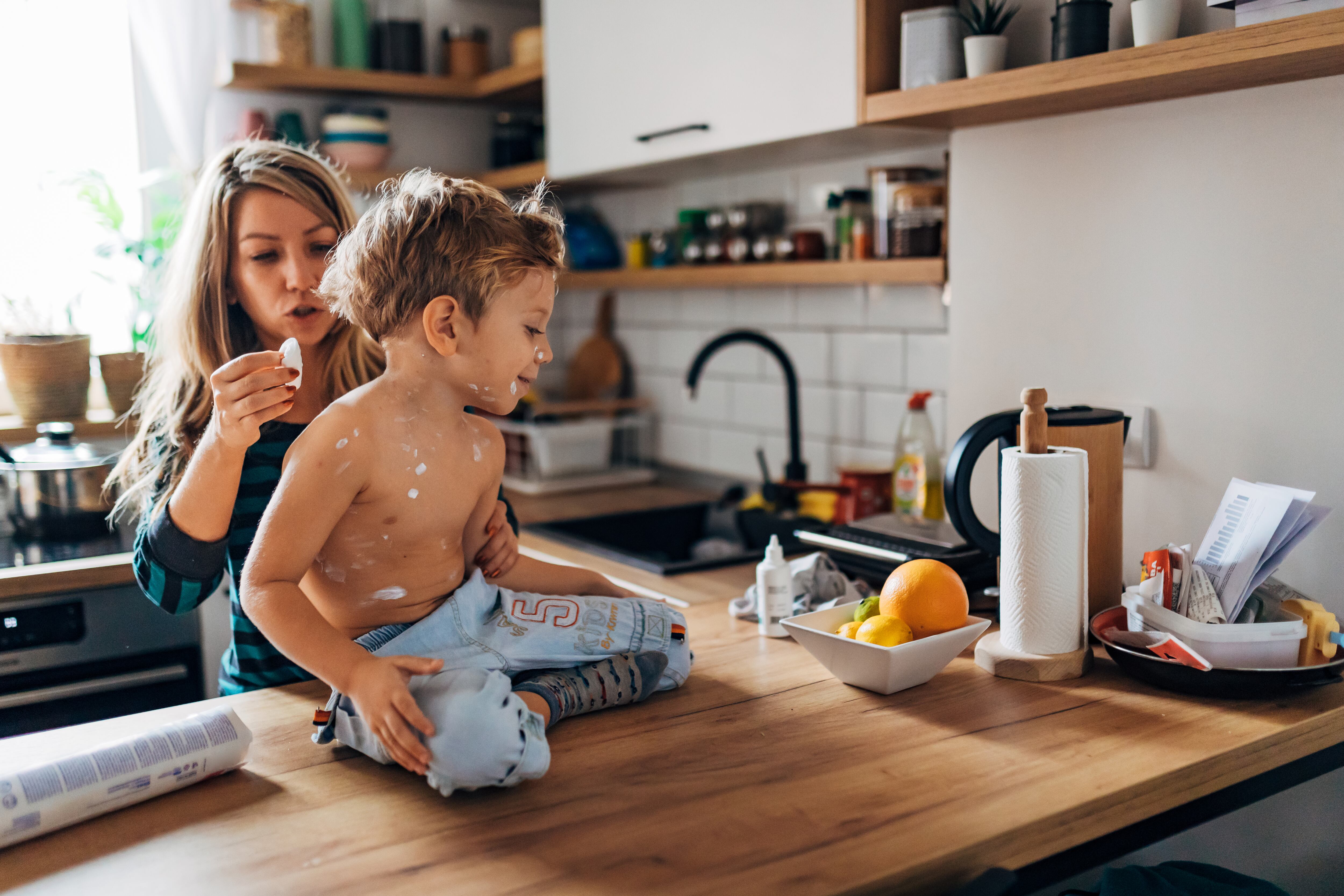 El 95 % de las personas pueden enfermarse de varicela a lo largo de su vida.