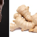 Expertos advierten que ante una marcada hinchazón en la rodilla es mejor consultar con el médico. Foto: Getty images montaje SEMANA.