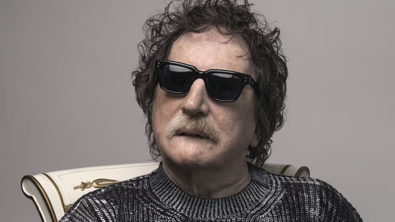 Charly García permanece bajo observación tras una cirugía renal.