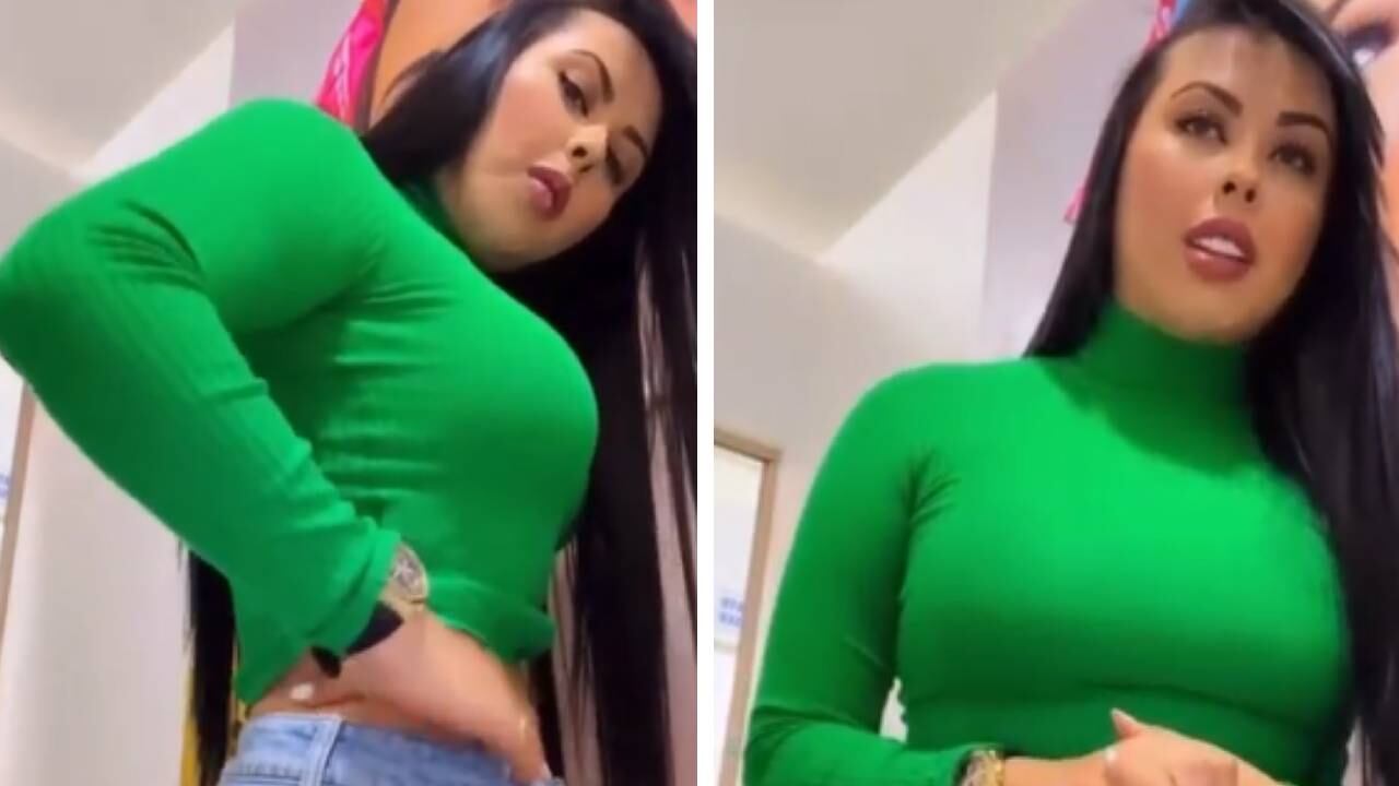 La hermana de la influenciadora mostró los cambios que ha tenido luego de su cirugía estética. Foto: Instagram @notitalentcol.