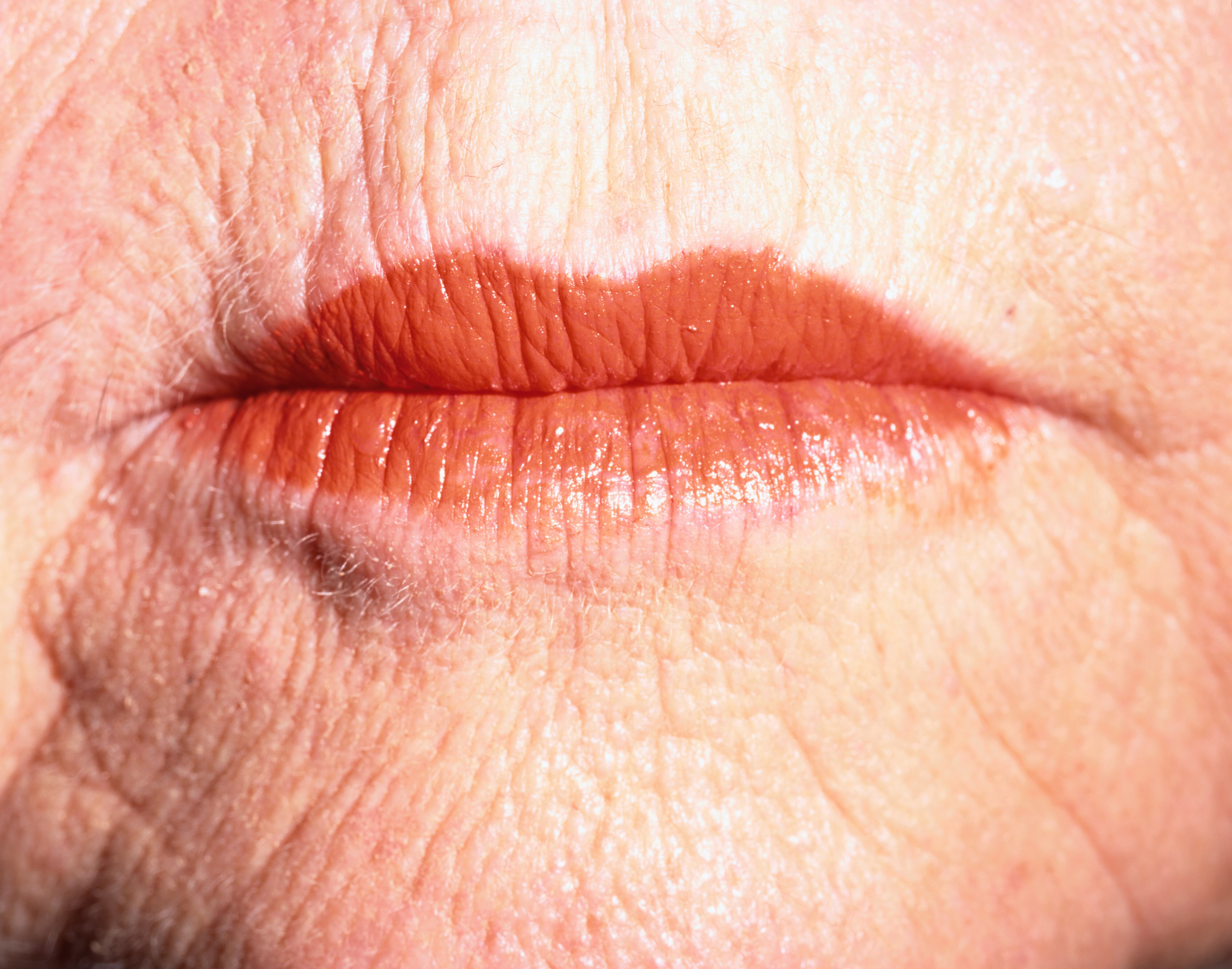 Las arrugas son signos de la edad.