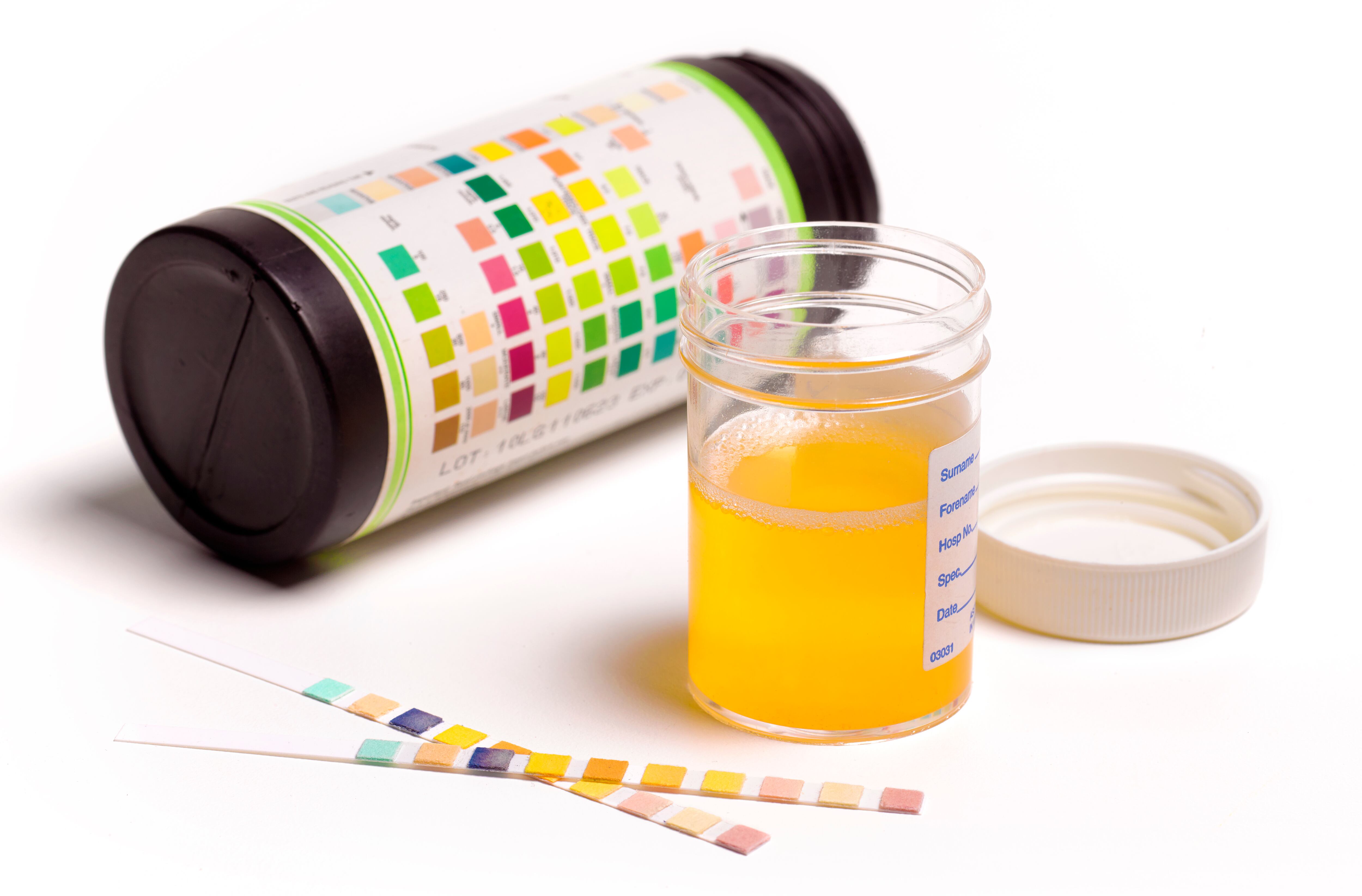 infecciones urinarias.