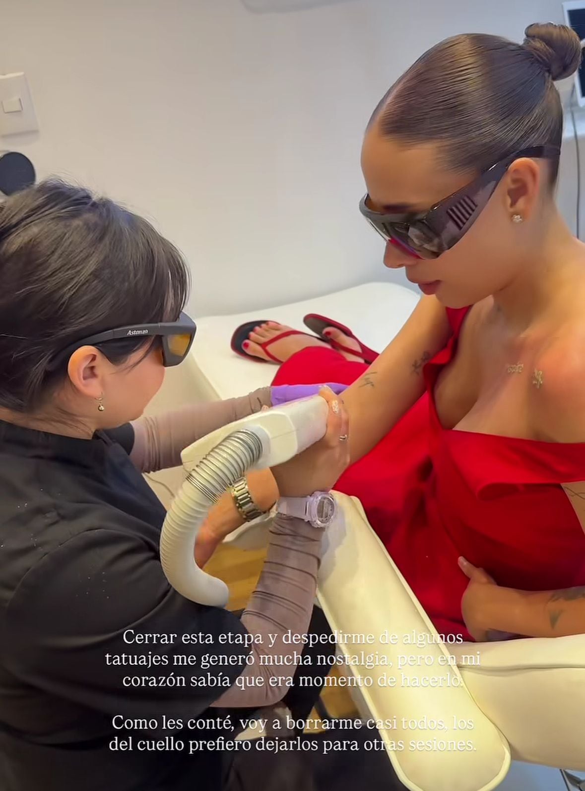 La creadora de contenido tomó la decisión de borrarse algunos tatuajes con un procedimiento láser.