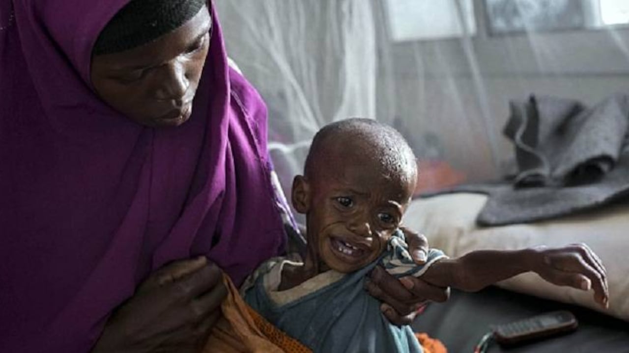 Niño padeciendo hambre en Somalia. Getty Images