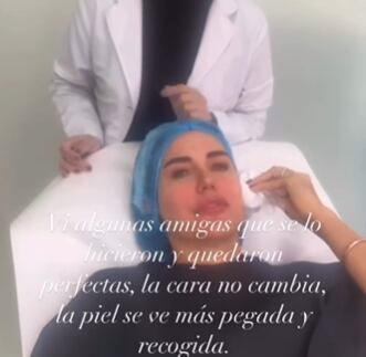 Se sometió a un retoque estético, puesto que quiere mantenerse joven y radiante.