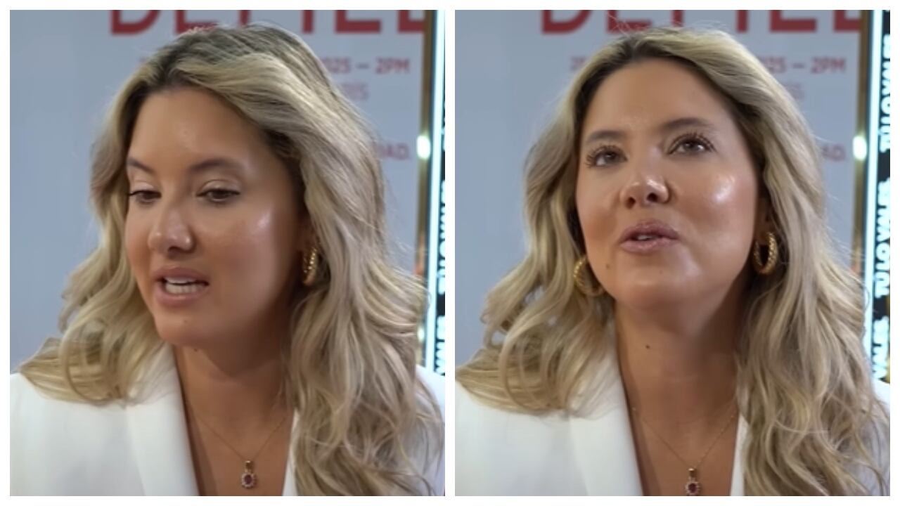 Daniela Álvarez habló del cambio que ha vivido después de que le amputaran su pierna.