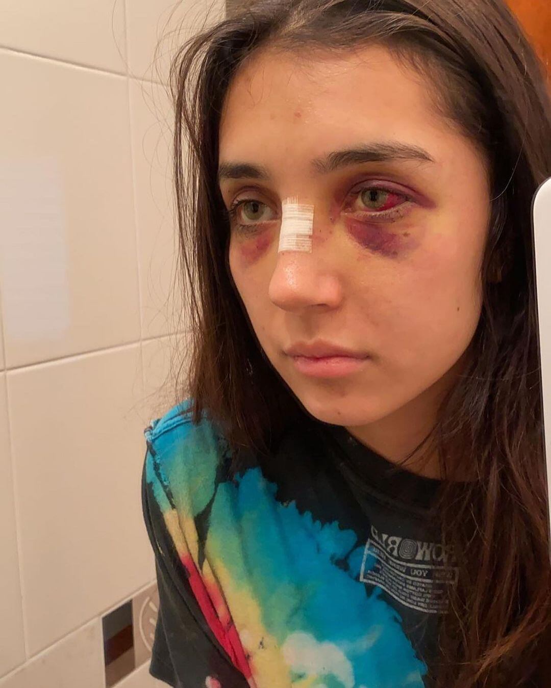 Desgarrador relato de joven maltratad y abusada por su expareja