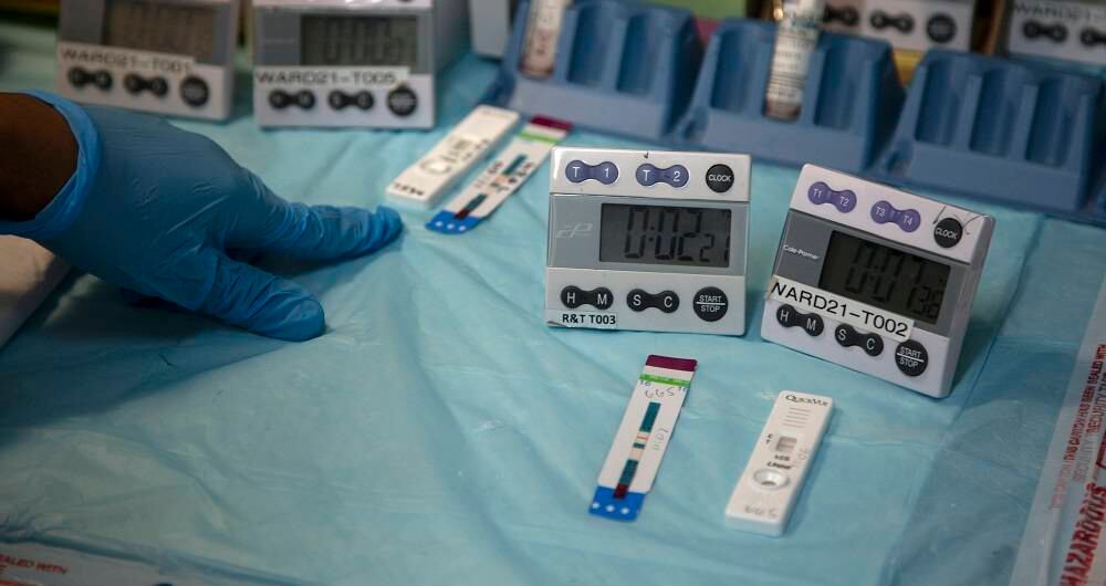 La detección temprana del VIH es clave para asegurar su tratamiento.