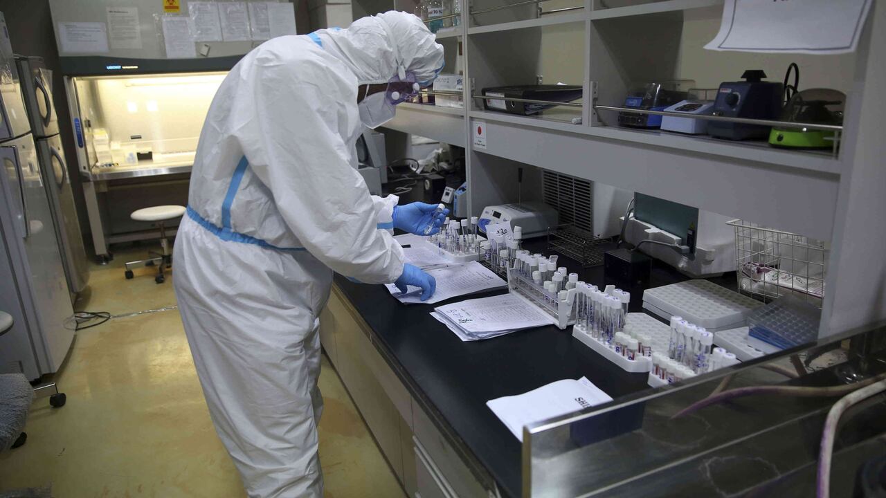 El nuevo sistema que ayudaría a detectar el coronavirus | Noticias hoy/Foto: AP