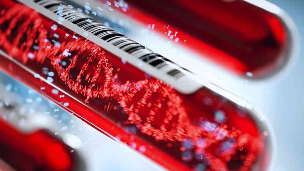 El riesgo de ictus o accidente cerebrovascular (ACV) temprano puede estar relacionado con las variantes genéticas asociadas con el grupo sanguíneo de una persona.