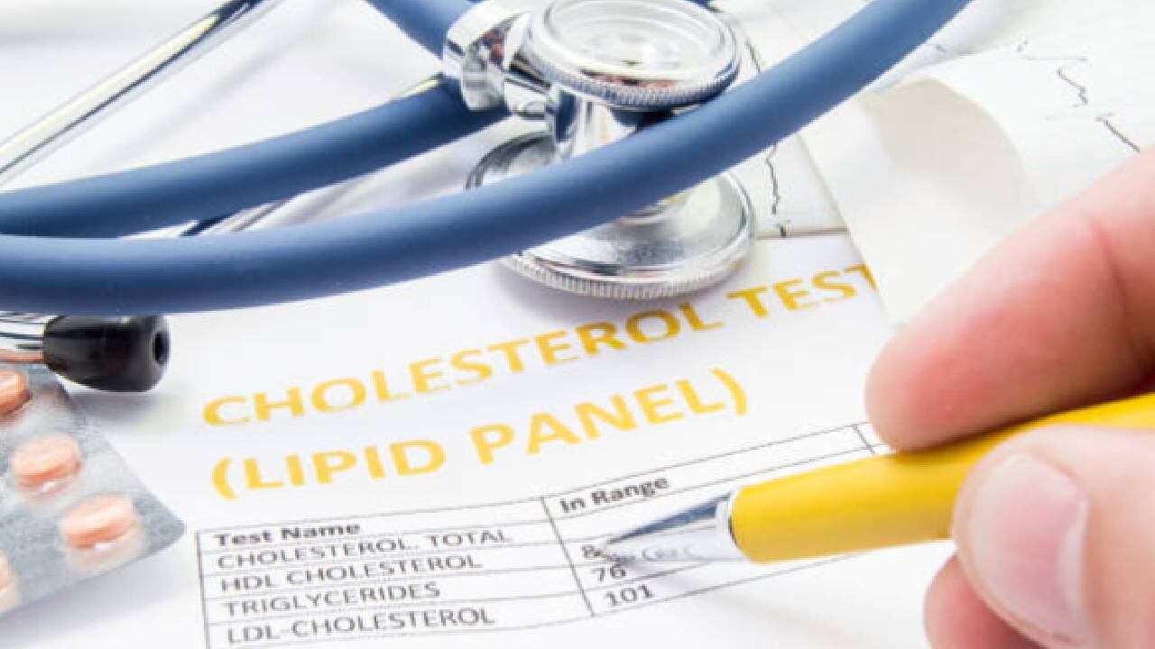 Demasiada cantidad de LDL en la sangre puede obstruir las arterias.