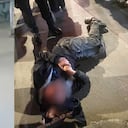 Caso de intolerancia dejó gravemente a un peatón en Bogotá.
