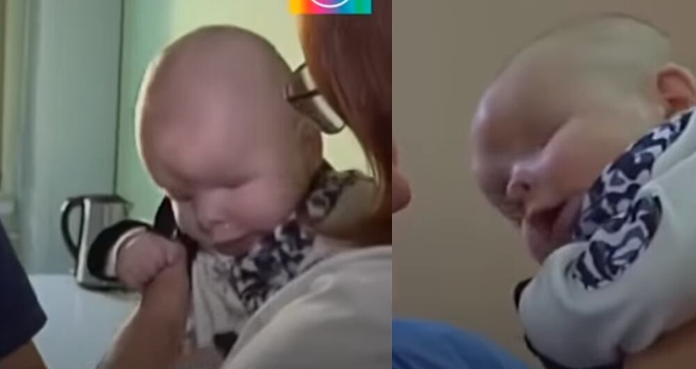 Bebé 'Smiley' nacido sin ojos finalmente encuentra un hogar amoroso.