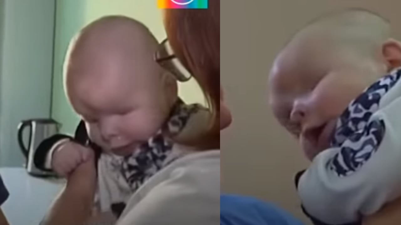 Bebé 'Smiley' nacido sin ojos finalmente encuentra un hogar amoroso.