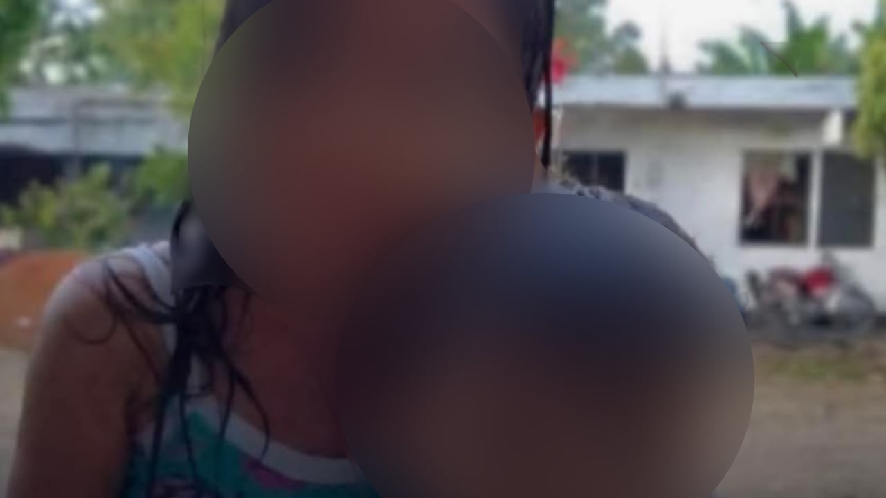 Al parecer, los dos menores se encontraban jugando y estaban solos en la casa cuando ocurrió todo.