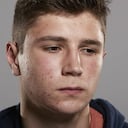 En temas de piel, la consulta más frecuente es el acné.