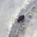 Una de las formas más fáciles de identificar una infestación de chinches es mediante las reveladoras marcas de picaduras en la cara, el cuello, los brazos, las manos o cualquier otra parte del cuerpo mientras duerme.