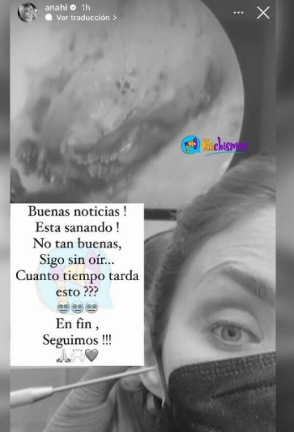 La cantante mostró cómo avanza su recuperación.