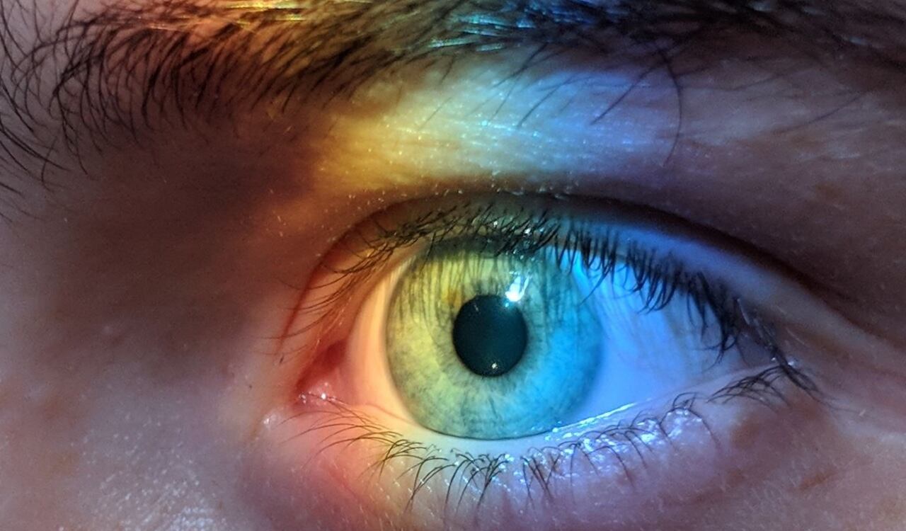 Los párpados caídos son una molestia para algunas mujeres