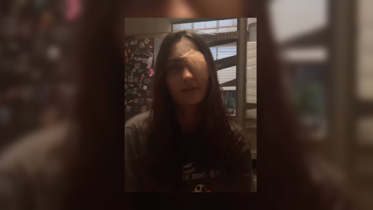Carol, la joven que publicó un video en TikTok explicando a dónde la llevó el mal uso de lentes de contacto