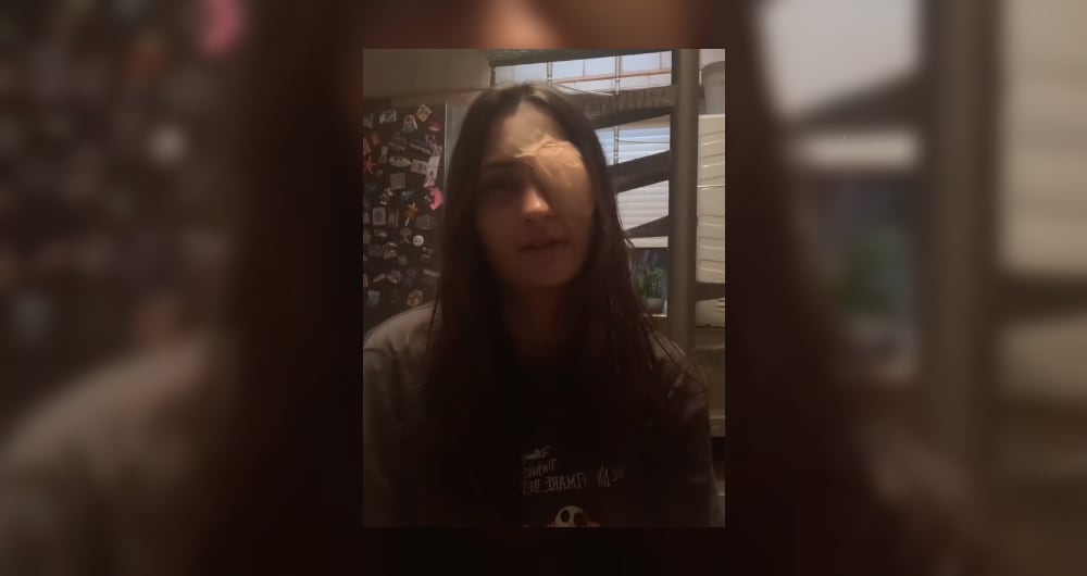 Carol, la joven que publicó un video en TikTok explicando a dónde la llevó el mal uso de lentes de contacto