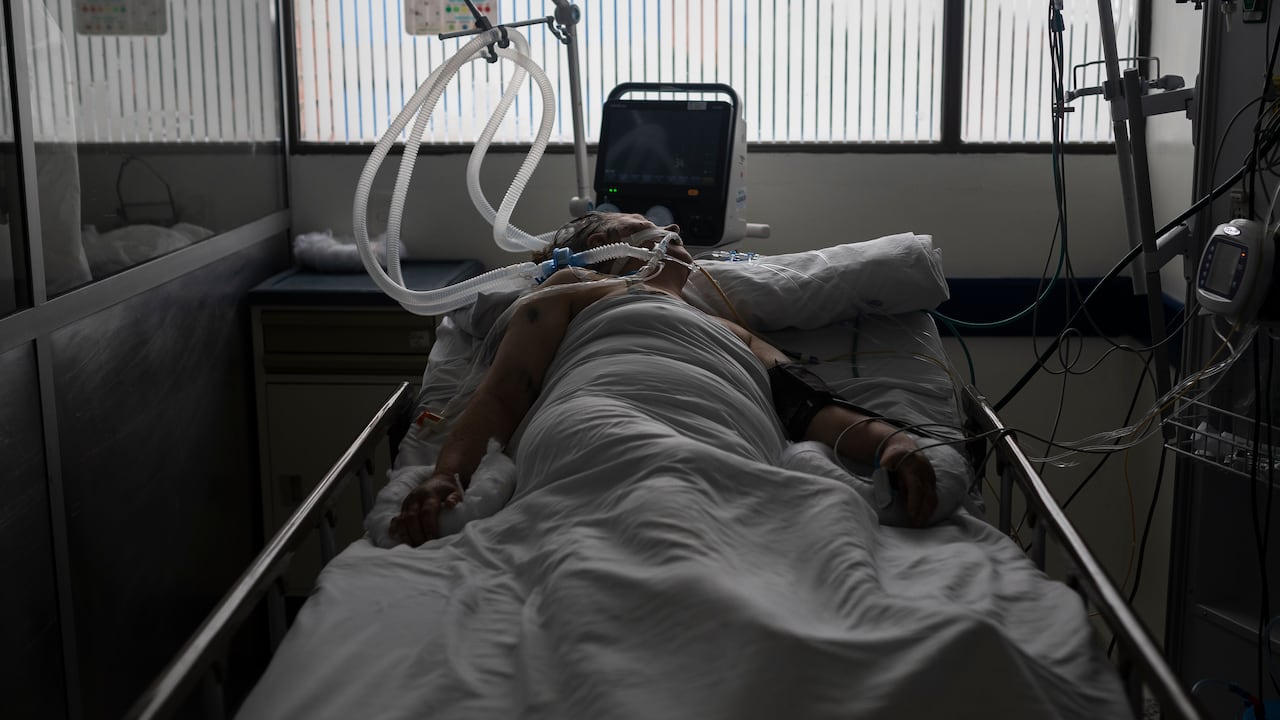 UCI HOSPITAL DEL TUNAL
PACIENTES CON COVID-19 SON ATENDIDOS EN LA SALA DE CUIDADOS INTENSIVOS DEL HOSPITAL EL TUNAL EN LA CIUDAD DE BOGOTA
COVID 19
CORONAVIRUS
25 DE JUNIO 2020
FOTO: ESTEBAN VEGA LA-ROTTA
REVISTA SEMANA