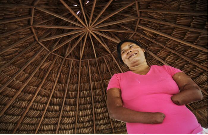 NUBIA: Nubia González es una indígena jiw que perdió las dos manos, un ojo y parcialmente la visión del otro a la edad de 20 años. El hecho ocurrió en el resguardo de Barrancón, ubicado a 15 minutos de San José del Guaviare, cuando, en compañía de otros miembros de su familia, recogía desechos y chatarra en el terreno del resguardo que colinda con las instalaciones de la Escuela de Fuerzas Especiales de las Fuerzas Armadas. Nubia tomó en sus manos un objeto que estalló inesperadamente. Ella y siete miembros de su familia terminaron heridos. Actualmente Nubia, en compañía de sus padres y hermanos, elabora artesanías, y espera que en el futuro los grupos armados entiendan el auto que en el 2009 expidió la Corte Constitucional, donde se advierte que los jiw son un pueblo en peligro de extinción por causa del conflicto armado.