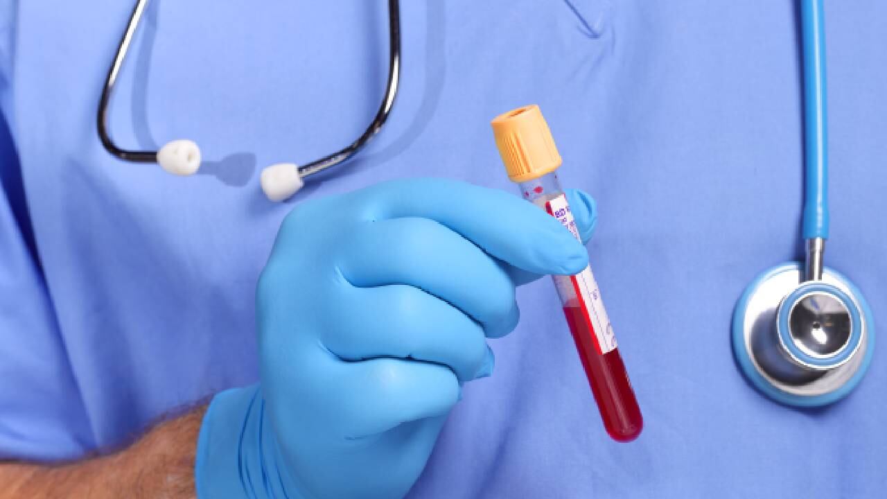 Una de las causas más frecuentes de la anemia es la falta de hierro en el organismo. Foto: Getty Images.