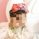 Mía aún no cumple dos años y ya ha sido sometida a 12 cirugías.