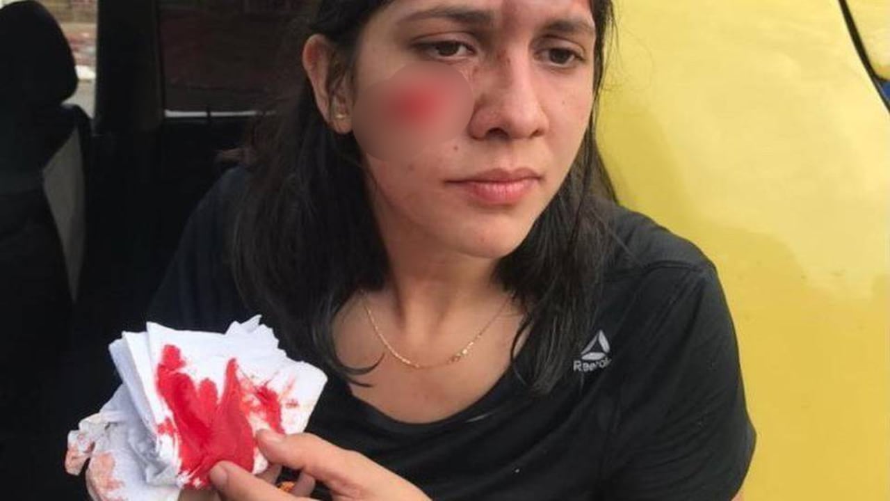 Diana Carreño fue atacada con una botella de vidrio