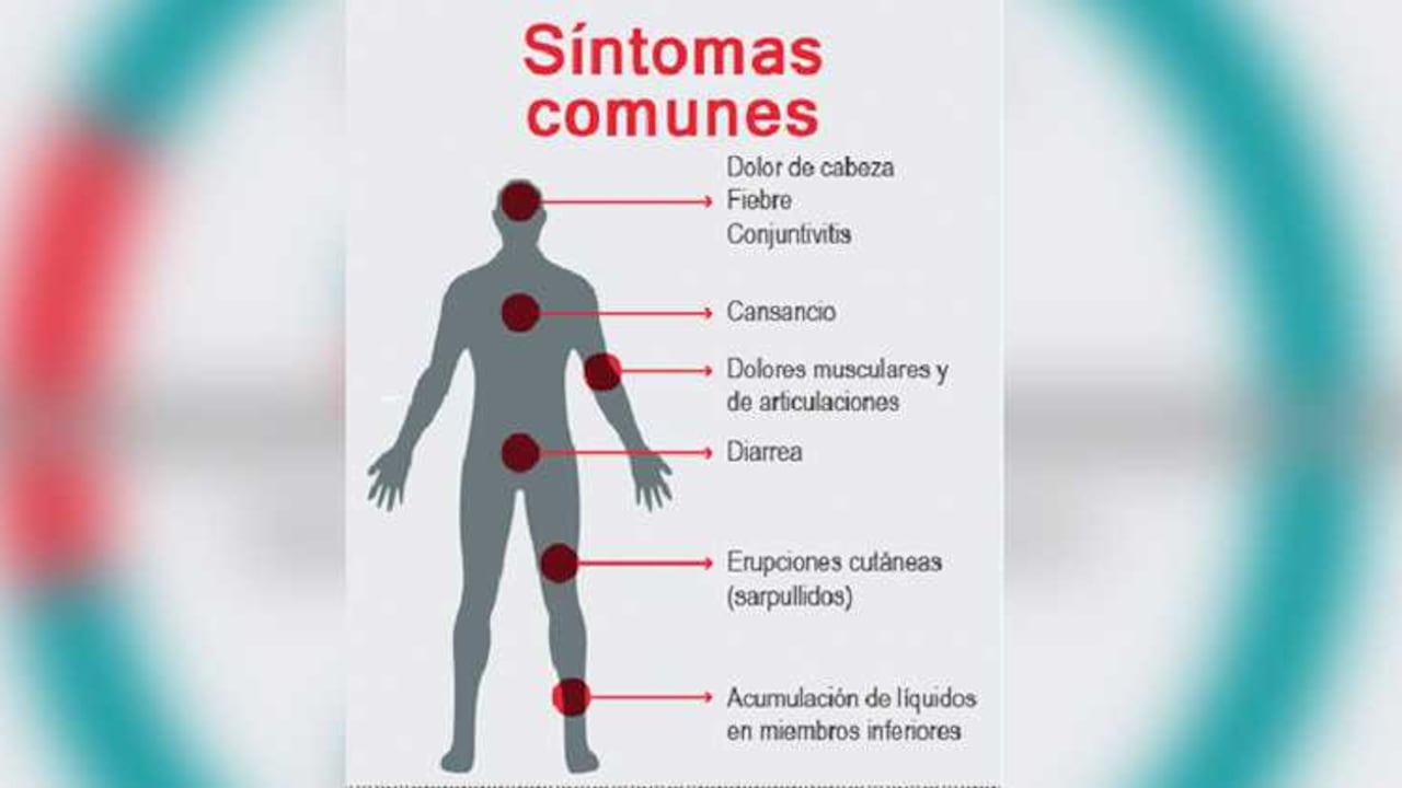 Síntomas del zika