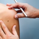 Consulta médica para observar los lunares