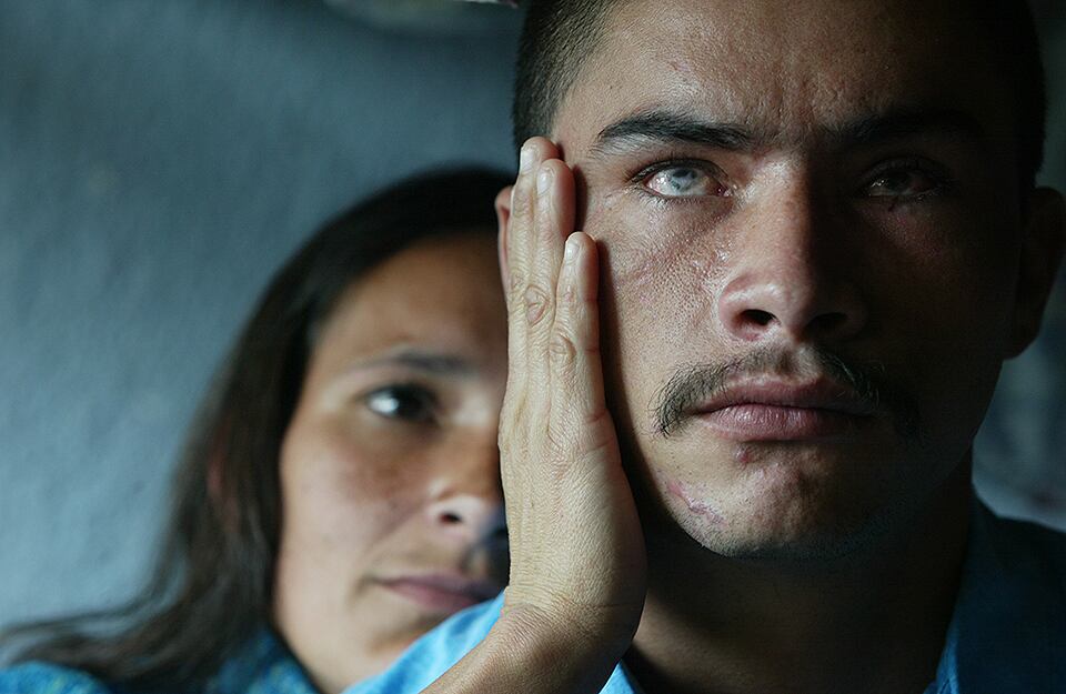 Marleni Ospina consuela a su esposo Nevardo Sánchez, quien quedó ciego tras la explosión de una mina antipersona. Esta foto se captó el 3 de abril de 2006 en una casa de atención a víctimas en Bogotá. (Foto: William Fernando Martinez)