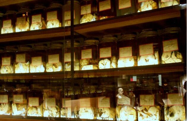 La colección Cushing de la Universidad de Yale en Estados Unidos alberga más de 500 cerebros y partes de cerebros que están en exposición permanente. Foto: oddthingsiveseen.com