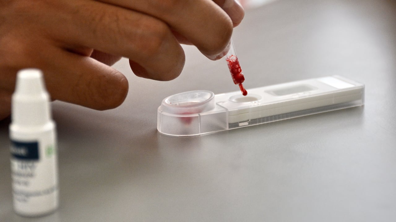 En el Hospital de Siloé, se puede acceder a pruebas gratuitas de VIH. La Secretaría de Salud de Cali ha instalado una máquina dispensadora de autotest de VIH en este centro de salud, la cual permite realizar pruebas rápidas, privadas y en solo 15 minutos. Foto Jorge Orozco /El País