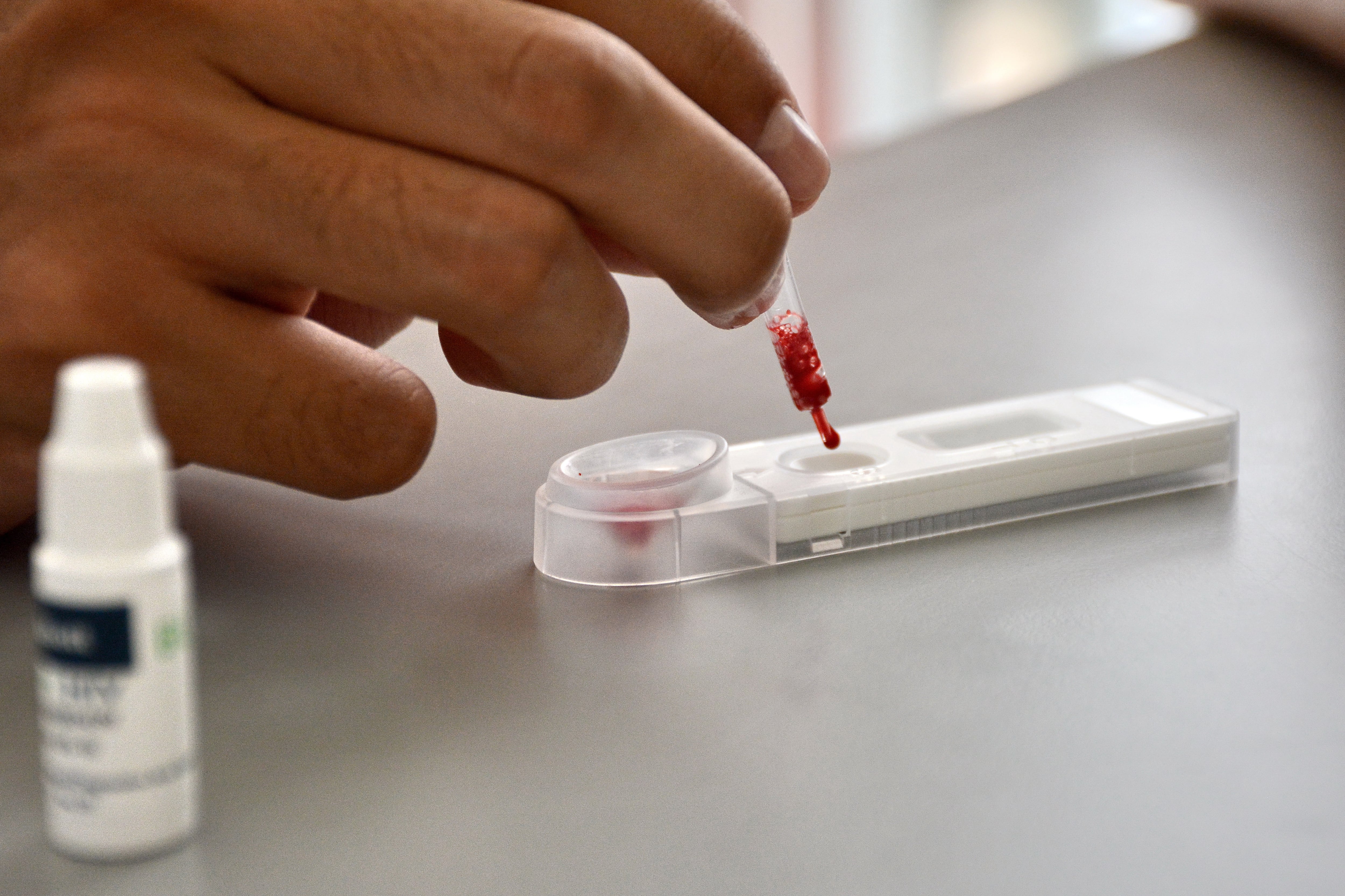 En el Hospital de Siloé, se puede acceder a pruebas gratuitas de VIH. La Secretaría de Salud de Cali ha instalado una máquina dispensadora de autotest de VIH en este centro de salud, la cual permite realizar pruebas rápidas, privadas y en solo 15 minutos. Foto Jorge Orozco /El País